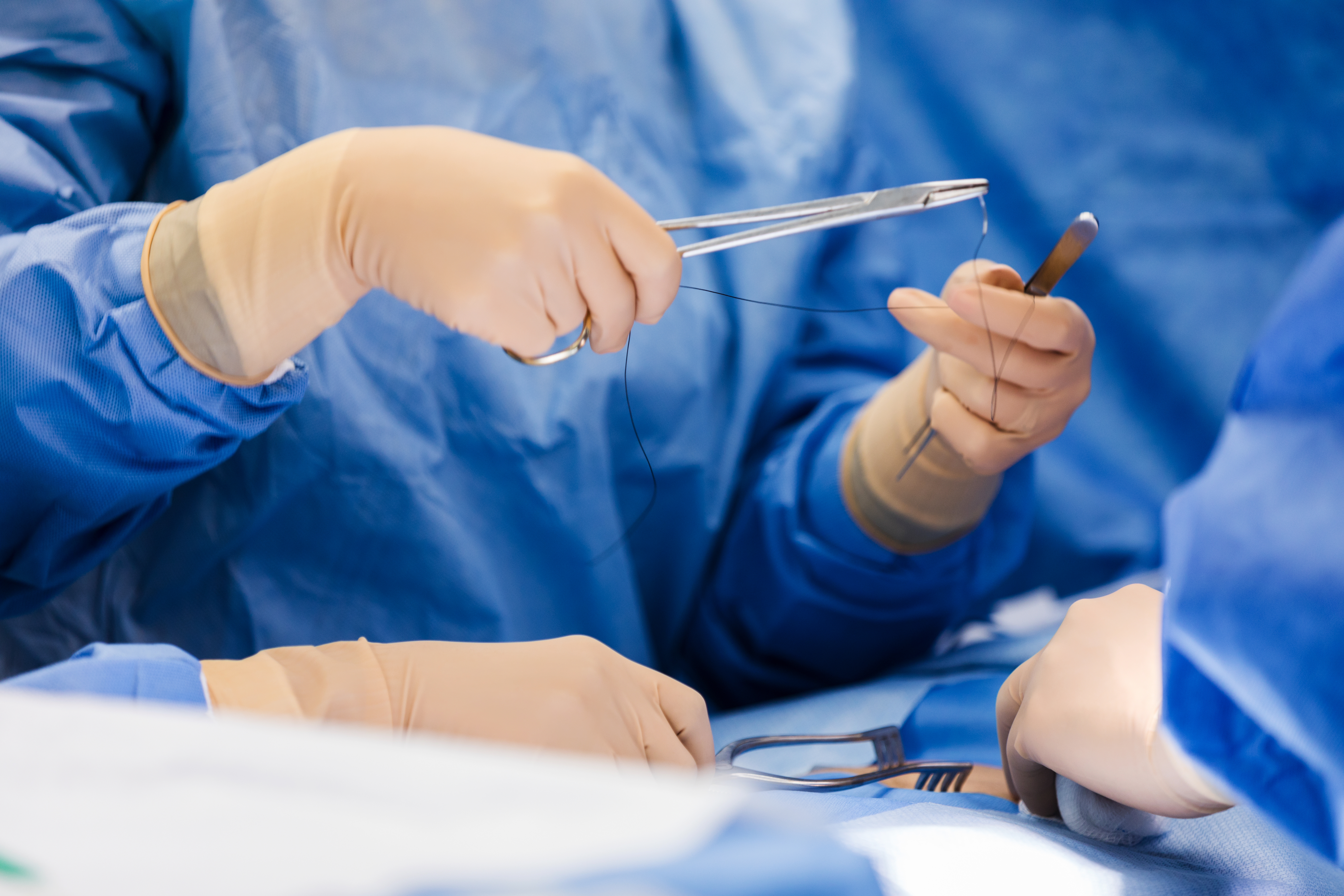Chirurgie ambulatoire