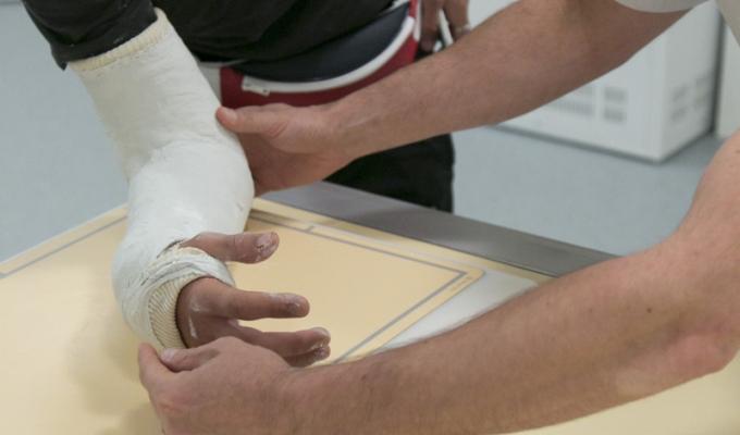 un patient avec un plâtre et in infirmier qui l'aide 